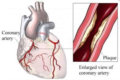 Diseases which requires Surgical Operation - See Achievement 1